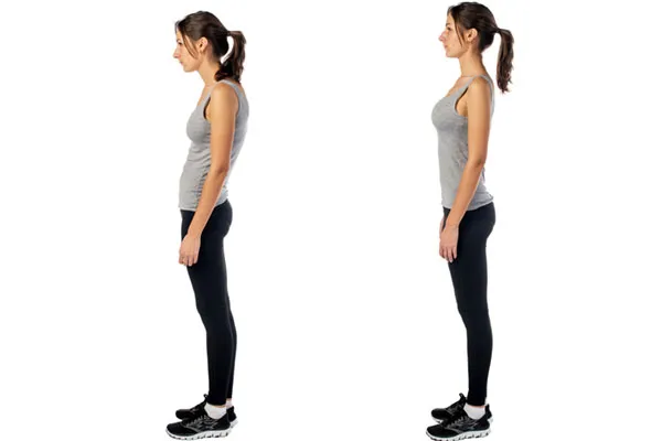 Side view of a woman standing with poor posture, then with good posture